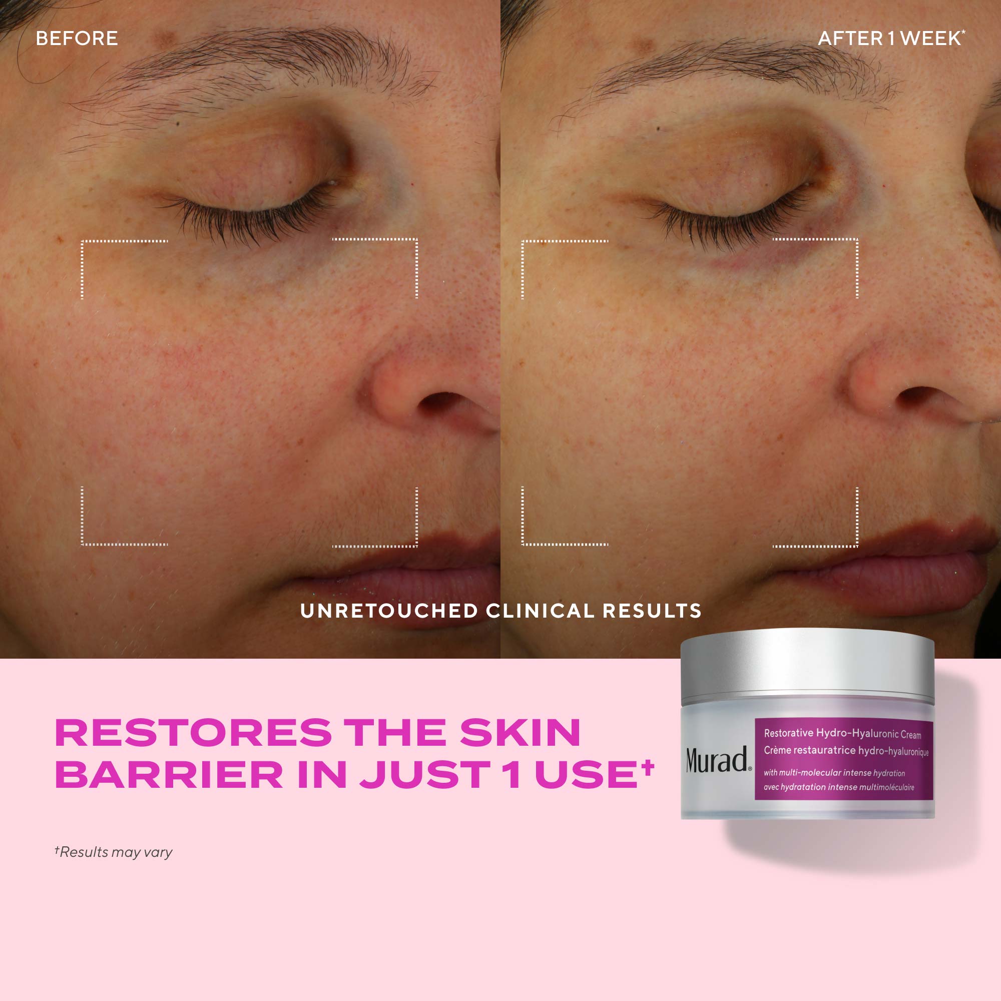 Restorative Hydro-Hyaluronic Cream