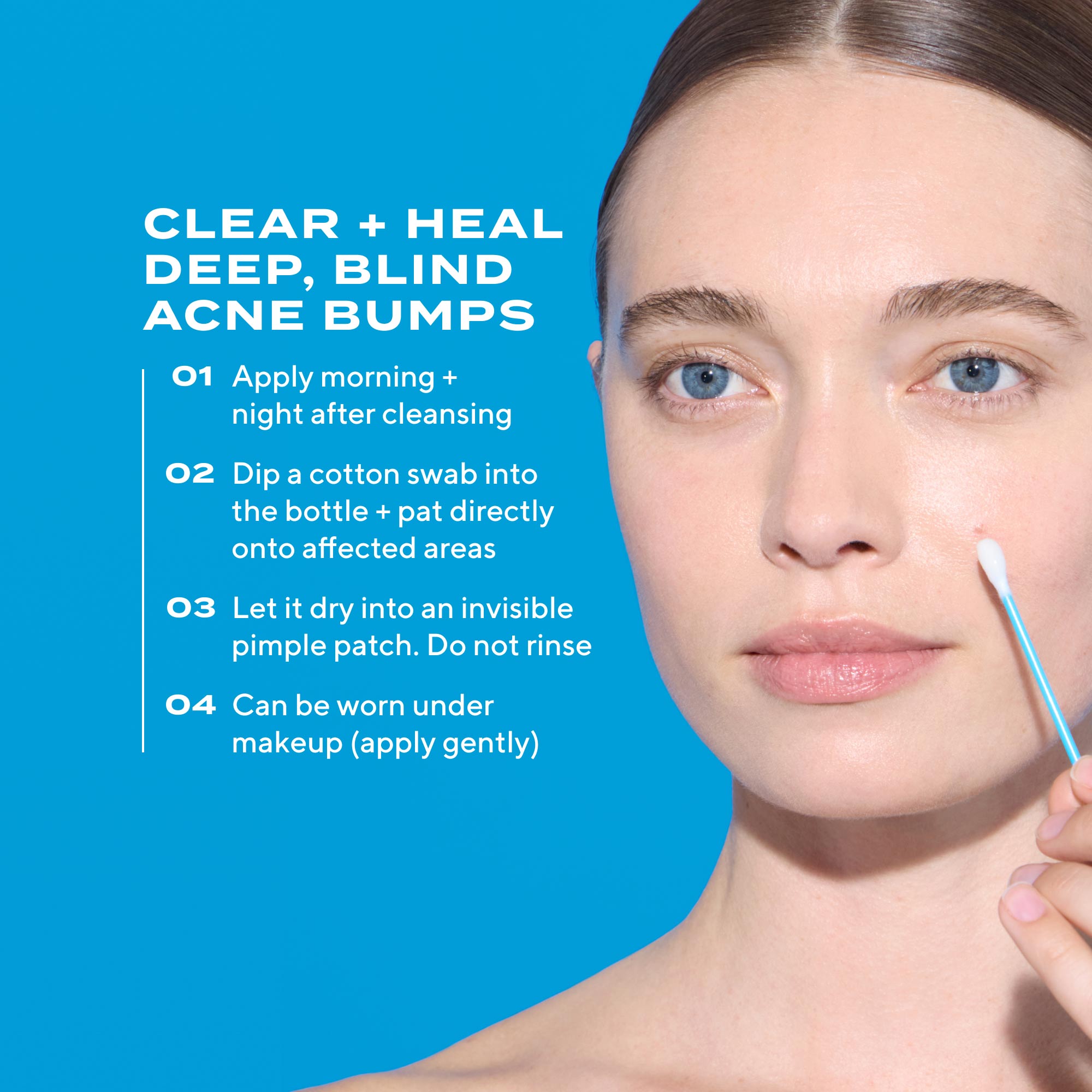 Deep Relief Acne Treatment