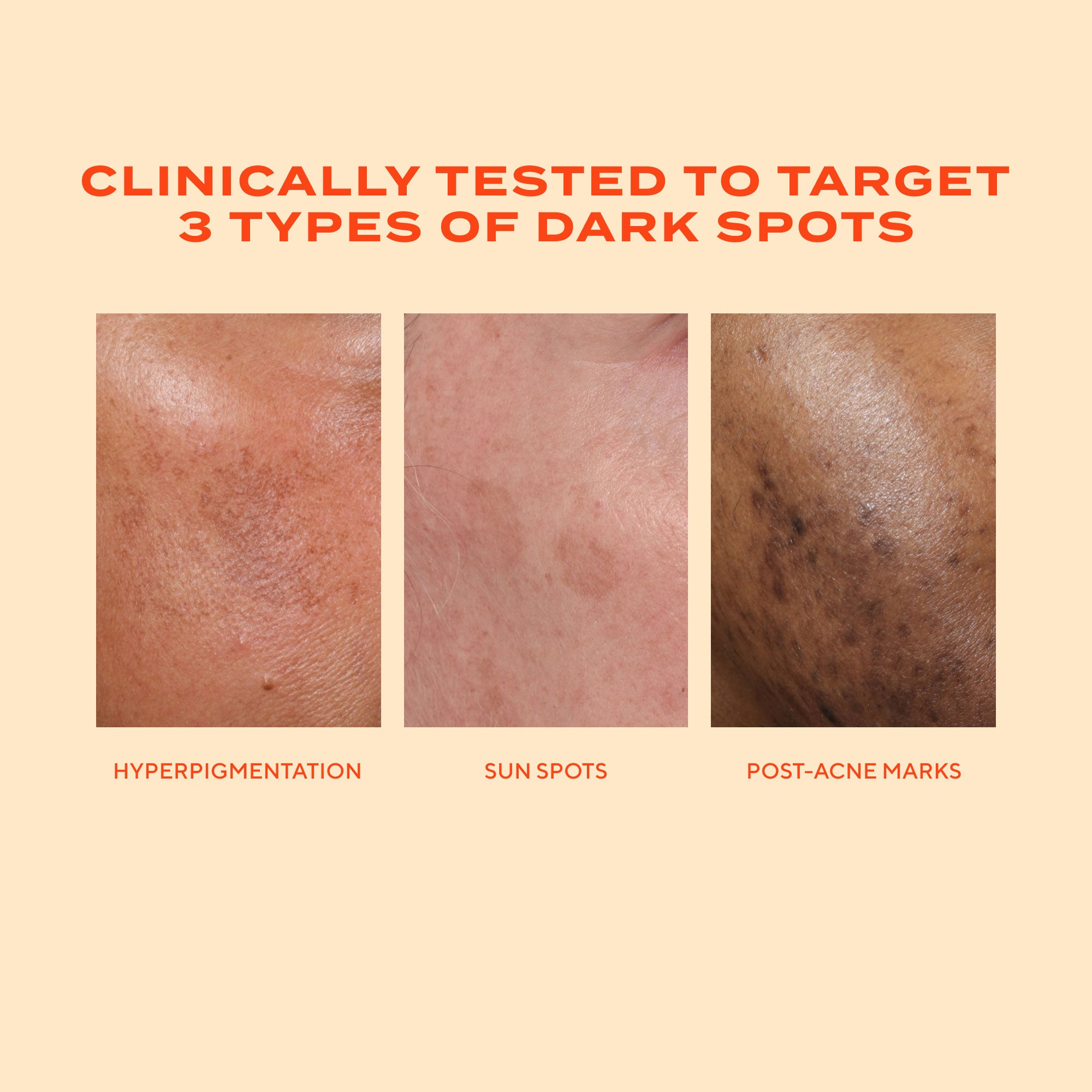 Rapid Dark Spot Correcting Serum