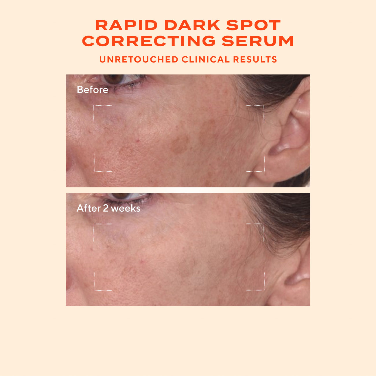 Derm Clinic: Target Dark Spots Value Set